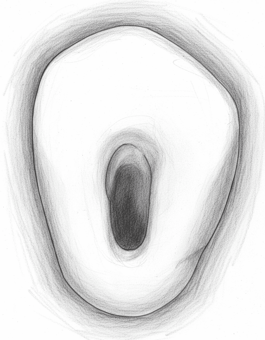 Mandibular Canine - Axial View showing ovoid access cavity