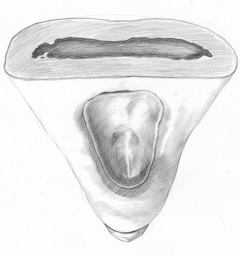 Mandibular Santral Kesici - Oval giriş kavitesini gösteren Aksiyal Görünüm