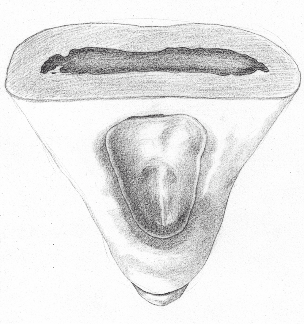 Mandibular Central Incisor - Axial View showing oval access cavity