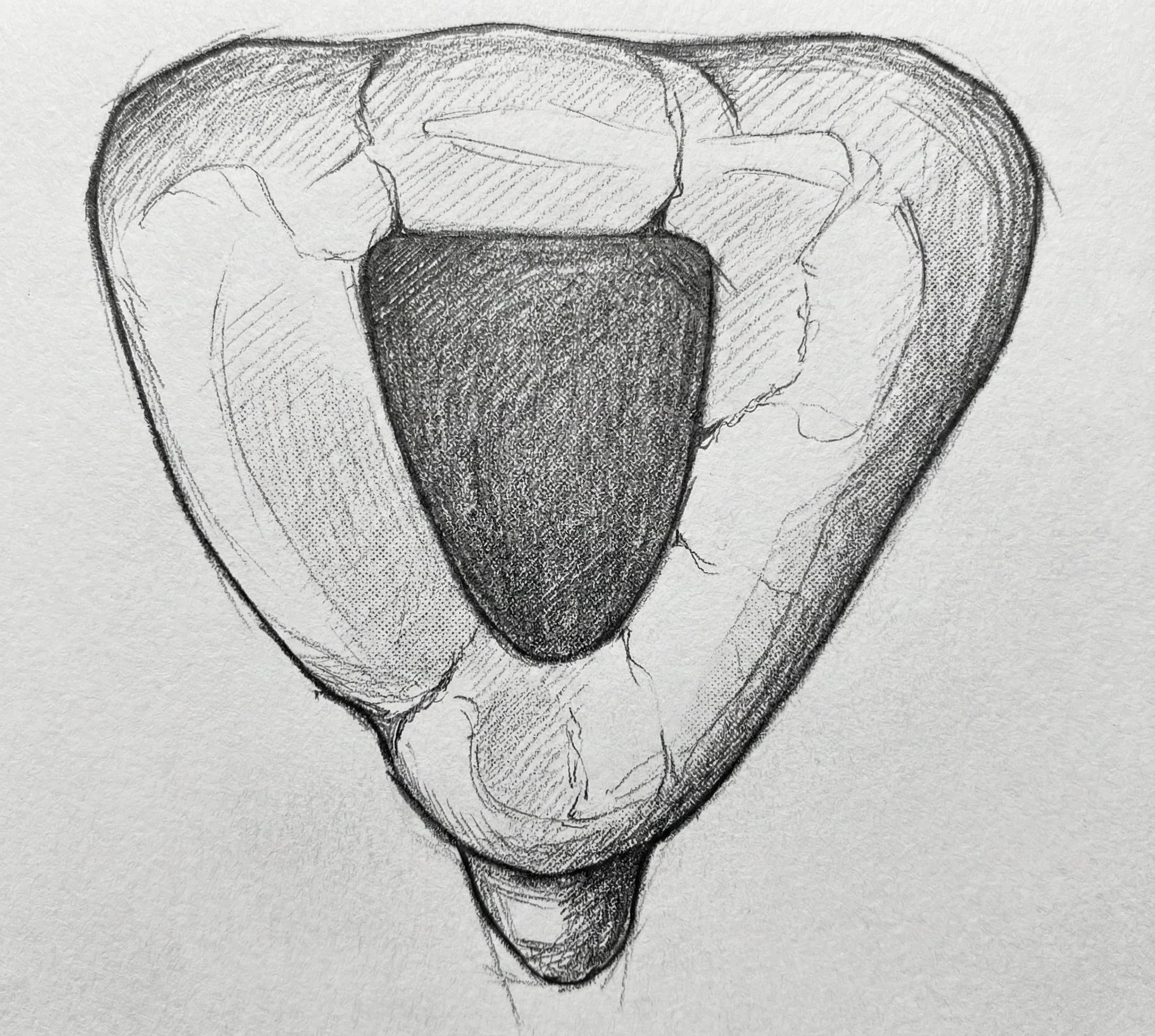 Maxillary Central Incisor - Axial View showing triangular access cavity